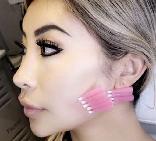 Threads treatment service